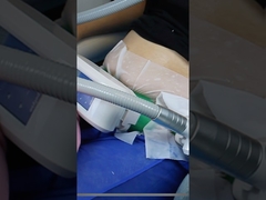 تا حالا امتحان کردي که چربی رو براي کاهش وزن منجمد کني؟