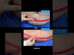 چربی رو منجمد کن، 4 سانتي متري در 1 ساعت از دست بده!