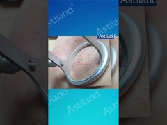 HIFU در مقابل لیزر CO2، کدام درمان ضد پیری را ترجیح می دهید؟