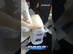 آزمایش انرژی HIFU