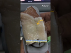 بیاین اثر لیفت فوری هایفو رو بررسی کنیم