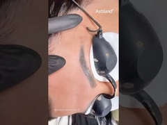 لیزر ان دی یاگ برای پاک کردن تاتو ابرو #لیزر_ان_دی_یاگ #پاک_کردن_تاتو_با_لیزر #دستگاه_زیبایی #کلینیک_لیزر